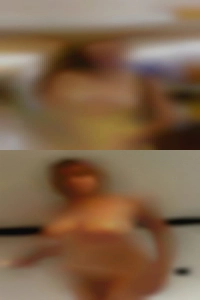 D/D free FWB or a third.